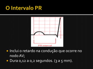  Inclui o retardo na condução que ocorre no
  nodo AV;
 Dura 0,12 a 0,2 segundos. (3 a 5 mm).
 