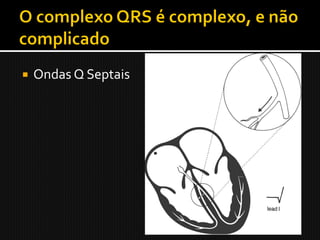    Ondas Q Septais
 