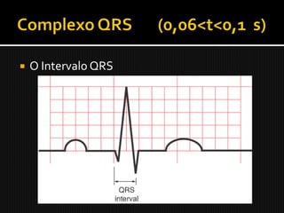    O Intervalo QRS
 