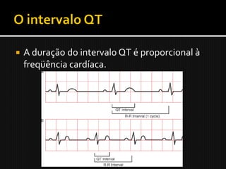    A duração do intervalo QT é proporcional à
    freqüência cardíaca.
 