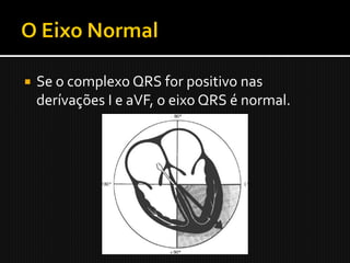    Se o complexo QRS for positivo nas
    derívações I e aVF, o eixo QRS é normal.
 