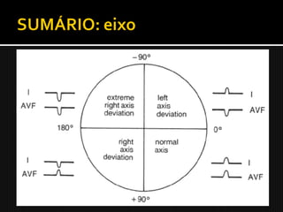1. O termo eixo refere-se à direção do vetor
   elétrico médio, representando a direção
   média do fluxo de corrente;
2. Para determinar o eixo, encontre a
   derivação na qual o complexo QRS é mais
   bifásica. O eixo deve situar-se em posição
   aproximadamente perpendicular ao eixo da
   derivação;
3. Uma rápida estimativa do eixo é feita
   olhando-se I e aVF.
 