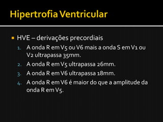    HVE – derivações precordiais
    1. A onda R em V5 ou V6 mais a onda S em V1 ou
       V2 ultrapassa 35mm.
    2. A onda R em V5 ultrapassa 26mm.
    3. A onda R em V6 ultrapassa 18mm.
    4. A onda R em V6 é maior do que a amplitude da
       onda R em V5.
 