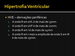    HVE – derivações periféricas
    1. A onda R em aVL é de mais de 13mm.
    2. A onda R em aVF é de mais de 21mm.
    3. A onda R em I é de mais de 14mm.
    4. A onda R em I mais a amplitude da onda S em III
       é de mais de 25mm.
 