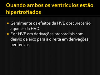  Geralmente os efeitos da HVE obscurecerão
  aqueles da HVD.
 Ex.: HVE em derivações precordiais com
  desvio de eixo para a direita em derivações
  periféricas
 