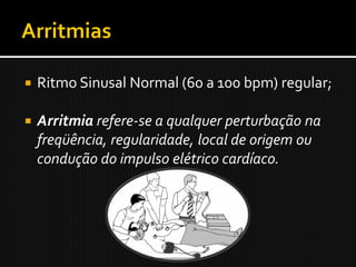    Ritmo Sinusal Normal (60 a 100 bpm) regular;

   Arritmia refere-se a qualquer perturbação na
    freqüência, regularidade, local de origem ou
    condução do impulso elétrico cardíaco.
 