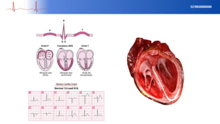 eletrocardiograma
 