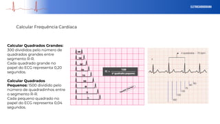 eletrocardiograma
Calcular Frequência Cardíaca
Calcular Quadrados Grandes:
300 divididos pelo número de
quadrados grandes entre
segmento R-R.
Cada quadrado grande no
papel do ECG representa 0,20
segundos.
Calcular Quadrados
Pequenos: 1500 dividido pelo
número de quadradinhos entre
o segmento R-R.
Cada pequeno quadrado no
papel do ECG representa 0,04
segundos.
 