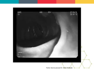 Fonte: Acervo pessoal Dr. Victor Andrade
 