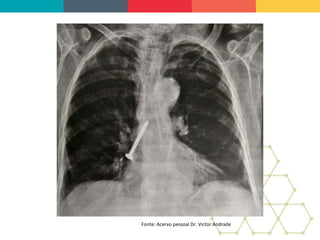 Fonte: Acervo pessoal Dr. Victor Andrade
 