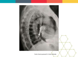 Fonte: Acervo pessoal Dr. Victor Andrade
 