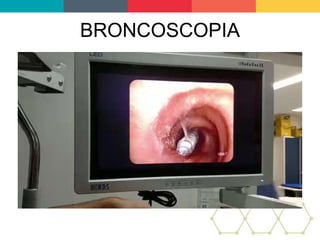 BRONCOSCOPIA
 