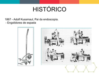 HISTÓRICO
1867 - Adolf Kussmaul, Pai da endoscopia.
- Engolidores de espada
 