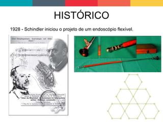 HISTÓRICO
1928 - Schindler iniciou o projeto de um endoscópio flexível.
 