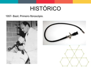 HISTÓRICO
1957- Basil, Primeiro fibroscópio.
 