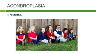ACONDROPLASIA
 Nanismo.
 