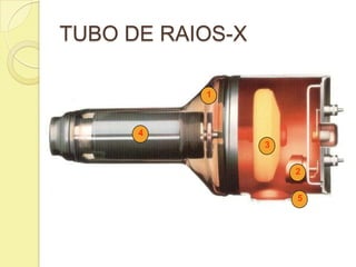 TUBO DE RAIOS-X
1
2
3
4
5
 