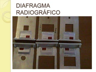 DIAFRAGMA
RADIOGRÁFICO
 