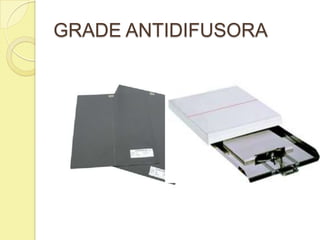GRADE ANTIDIFUSORA
 