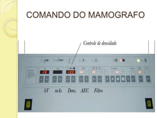 COMANDO DO MAMOGRAFO
 