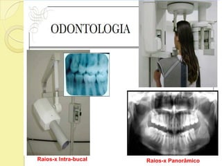 Raios-x Intra-bucal Raios-x Panorâmico
 