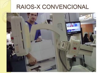 RAIOS-X CONVENCIONAL
 