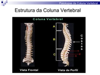 Patologias da Coluna Vertebral
Estrutura da Coluna Vertebral
 