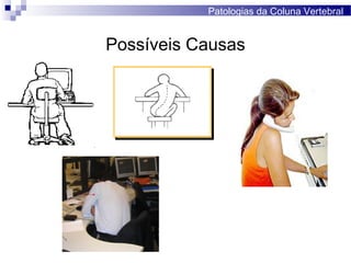 Possíveis Causas
Patologias da Coluna Vertebral
 