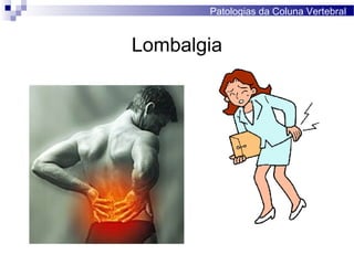 Lombalgia
Patologias da Coluna Vertebral
 