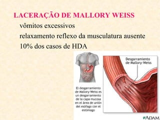 LACERAÇÃO DE MALLORY WEISS
 vômitos excessivos
 relaxamento reflexo da musculatura ausente
 10% dos casos de HDA
 