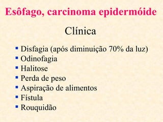 Esôfago, carcinoma epidermóide
               Clínica
  Disfagia (após diminuição 70% da luz)
  Odinofagia
  Halitose
  Perda de peso
  Aspiração de alimentos
  Fístula
  Rouquidão
 