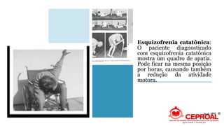 Esquizofrenia catatônica:
O paciente diagnosticado
com esquizofrenia catatônica
mostra um quadro de apatia.
Pode ficar na mesma posição
por horas, causando também
a redução da atividade
motora.
 