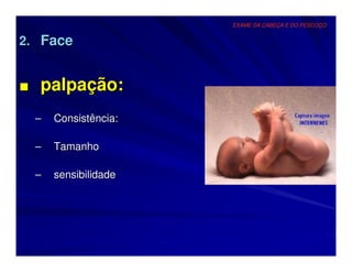 EXAME DA CABEÇA E DO PESCOÇO


2. Face


■ palpação:
  –   Consistência:

  –   Tamanho

  –   sensibilidade
 