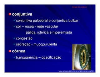 EXAME DA CABEÇA




conjuntiva
 conjuntiva palpebral e conjuntiva bulbar
 cor – rósea - rede vascular
         pálida, ictérica e hiperemiada
 congestão
 secreção - mucopurulenta
córnea
 transparência – opacificação


                               www.snopes.com/horrors/ techno/cornea.htm
 