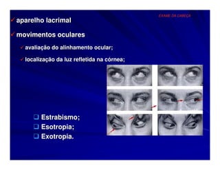 EXAME DA CABEÇA
aparelho lacrimal

movimentos oculares
  avaliação do alinhamento ocular;

  localização da luz refletida na córnea;




        Estrabismo;
        Esotropia;
        Exotropia.
 