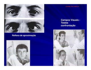EXAME DA CABEÇA




                         Campos Visuais -
                         Testes
                         confrontação



Reflexo de aproximação
 