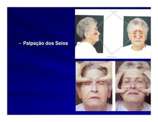 – Palpação dos Seios
 