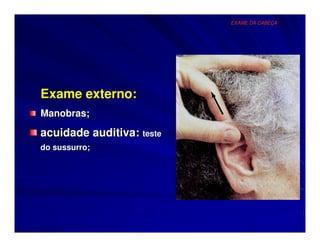 EXAME DA CABEÇA




Exame externo:
Manobras;

acuidade auditiva: teste
do sussurro;
 
