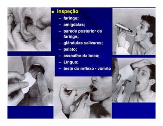 ■ Inspeção
  – faringe;
  – amígdalas;
  – parede posterior da
    faringe;
  – glândulas salivares;
  – palato;
  – assoalho da boca;
  – Língua;
  – teste do reflexo - vômito
 
