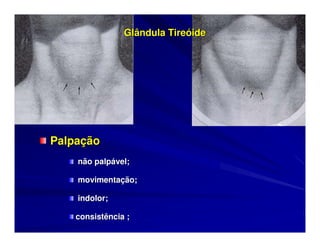 Glândula Tireóide




Palpação
    não palpável;

    movimentação;

    indolor;

    consistência ;
 