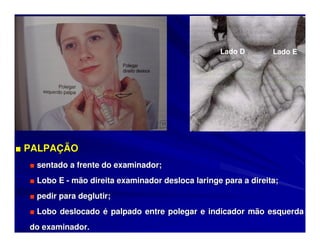 EXAME DO PESCOÇO



                                                   Lado D        Lado E




■ PALPAÇÃO
  ■ sentado a frente do examinador;
  ■ Lobo E - mão direita examinador desloca laringe para a direita;
  ■ pedir para deglutir;
  ■ Lobo deslocado é palpado entre polegar e indicador mão esquerda
  do examinador.
 