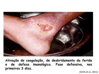 (SILVA et al., 2011)
Remodelação do colágeno e redução da
capilarização, com retração da ferida e
formação da cicatriz. Fa...
