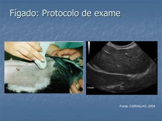 Fígado: Protocolo de exame
Fonte: CARVALHO, 2004
 