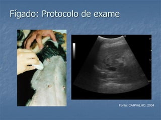 Fígado: Protocolo de exame
Fonte: CARVALHO, 2004
 