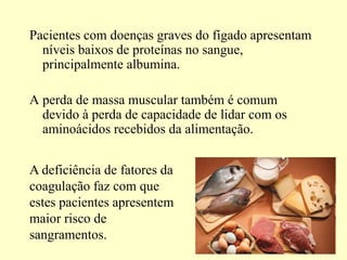 Pacientes com doenças graves do fígado apresentam
níveis baixos de proteínas no sangue,
principalmente albumina.
A perda de massa muscular também é comum
devido à perda de capacidade de lidar com os
aminoácidos recebidos da alimentação.
A deficiência de fatores da
coagulação faz com que
estes pacientes apresentem
maior risco de
sangramentos.
 