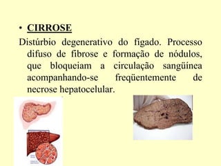 • CIRROSE
Distúrbio degenerativo do fígado. Processo
difuso de fibrose e formação de nódulos,
que bloqueiam a circulação sangüínea
acompanhando-se freqüentemente de
necrose hepatocelular.
 
