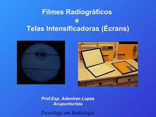 Filmes Radiográficos
e
Telas Intensificadoras (Écrans)
Prof.Esp. Adoniran Lopes
Acupunturista
Tecnólogo em Radiologia
 