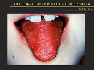 DISCIPLINA DE ANATOMIA DE CABEÇA E PESCOÇO
Prof: Tony Carlos
 