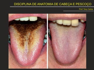 DISCIPLINA DE ANATOMIA DE CABEÇA E PESCOÇO
Prof: Tony Carlos
 