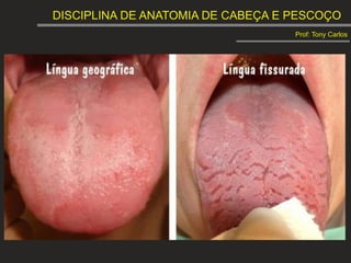 DISCIPLINA DE ANATOMIA DE CABEÇA E PESCOÇO
Prof: Tony Carlos
 